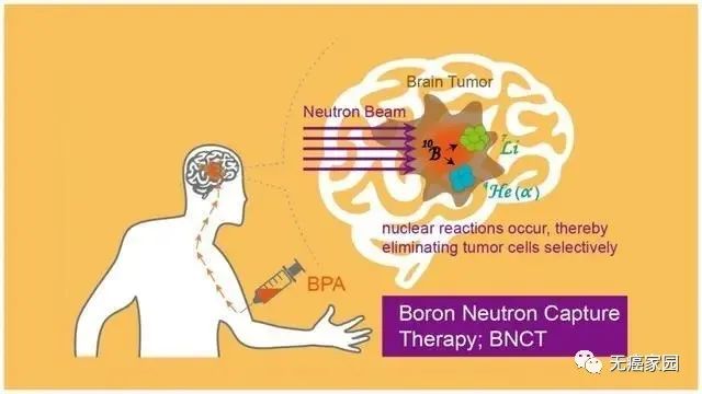 天博tb官网链接肿瘤诊治需要 整合医学思维(图1)